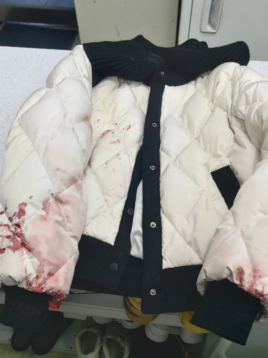 施工前:シミ・黄変のある白ジャケット